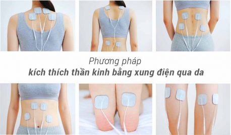 Phương pháp điện xung trị liệu