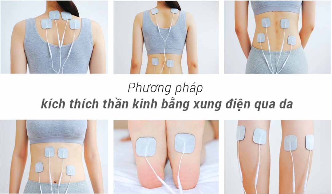 Máy điện xung kích thích thần kinh cơ TS3